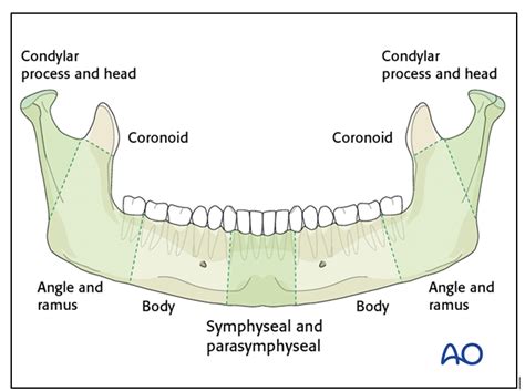 Mandibular Fracture Classification