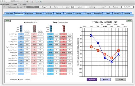 Audiogram Set-up Symbols - HearForm Features - HearForm