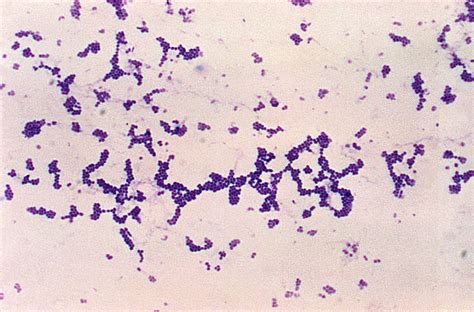 Free picture: photomicrograph, spherical, cocci, gram, positive ...