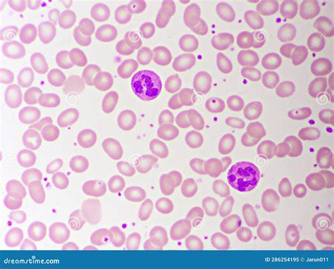 Segmented Neutrophil Cell in Human Blood Smear Stock Image - Image of ...