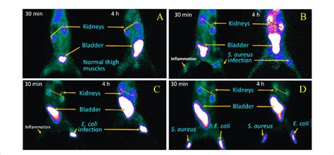 SPECT gamma camera scintigraphy images, at 30 min and 4 h post ...