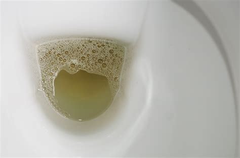 Foamy Urine: Is it a Symptom of a Kidney Disease? | BlackDoctor.org