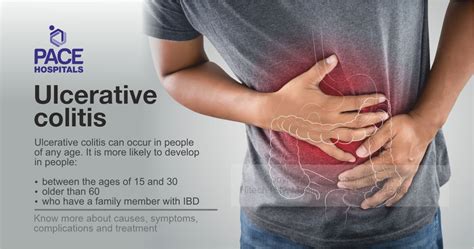 Ulcerative colitis: causes, symptoms, complications and treatment