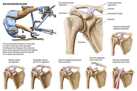 What is an AC joint injury, and why is it so common in contact sports ...