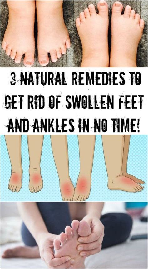 3 NATURAL REMEDIES TO GET RID OF SWOLLEN FEET AND ANKLES IN NO TIME ...