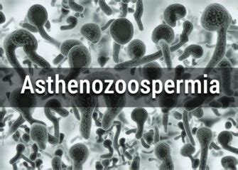 What is asthenozoospermia? - Causes, Effects, Diagnosis & Treatment