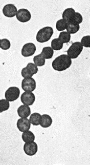 Streptococcus pyogenes - microbewiki