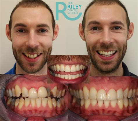 The Riley Dental Studio - Invisalign Stoke on Trent