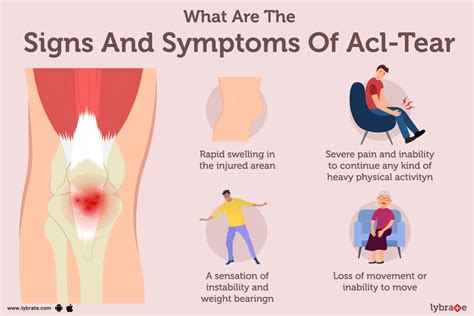 Acl Injury Symptoms