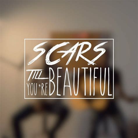 ”Scars To Your Beautiful” Lyrics-Alessia Cara - Panda Cutie