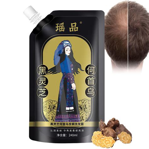 Amazon.com : Ginger Plant Extract Anti-Hair Loss Hair Shampoo,Ginger ...