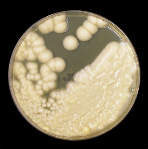 Fun With Microbiology (What's Buggin' You?): Trichosporon species