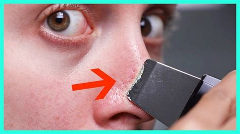 DEEP CLEANING PORES WITH SPATULA - YouTube