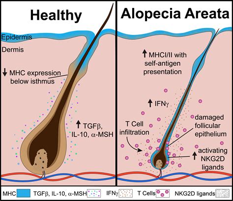 Frontiers | An overview of JAK/STAT pathways and JAK inhibition in ...