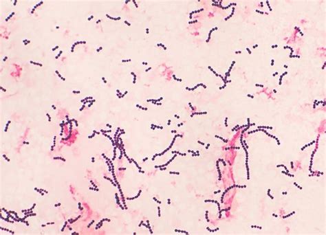 Streptococcus Pyogenes (Group A Strep)