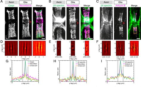 [PDF] Ultrastructural anatomy of nodes of Ranvier in the peripheral ...