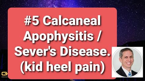 #5 Calcaneal Apophysitis / Sever's Disease /Kid Heel pain. Dr Dan ...