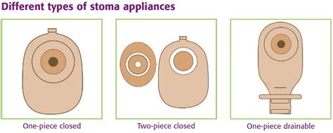 Colostomy - How To Change A Colostomy Bag & Living With It