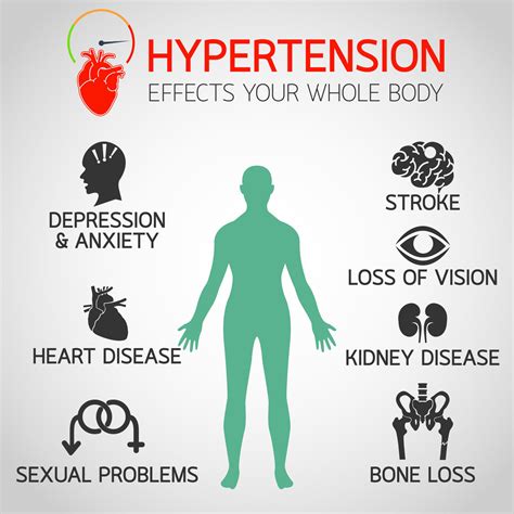 Hypertension: Symptoms and Causes - Pulse Cardiology