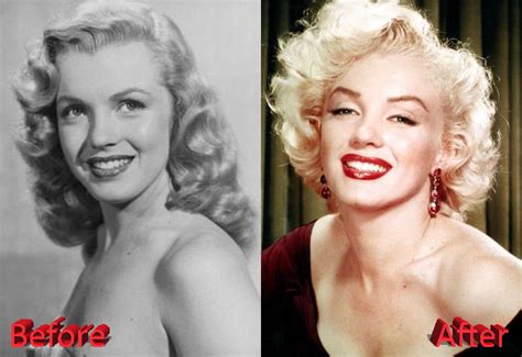 Marilyn Monroe Plastic Surgery: A Shooting Star