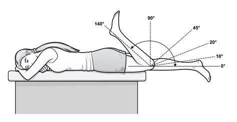 Quadriceps Tendon Rupture: ROM