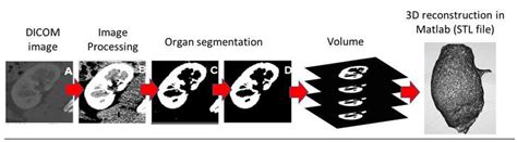 3D reconstruction process. Source: | Download Scientific Diagram