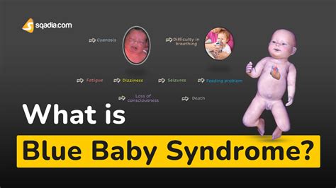 What is Blue Baby Syndrome?