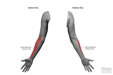 Lateral Antebrachial Cutaneous Nerve | Peripheral Nerve Surgery ...