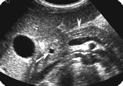 THE NORMAL PANCREAS - Radiology Imaging