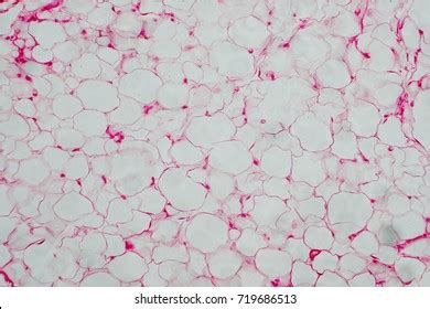 Humanbody Fat Cells Under Microscope View Stock Photo 719686513 ...