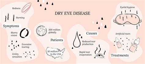 What is Dry Eye Disease - CorneaCare | Eyecare Made Easy