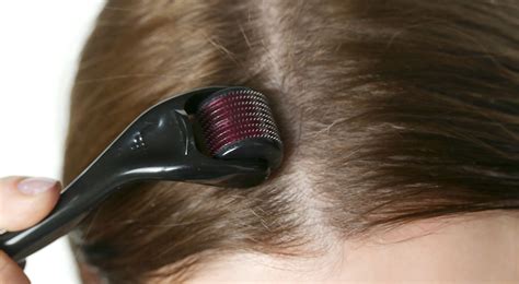 Derma Roller: Will It Help With Hair Growth? | Healthnews