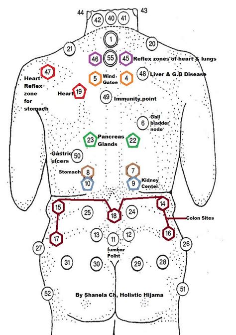 Cupping Points, Hijama Cupping, Cupping Therapy, Acupuncture Points ...