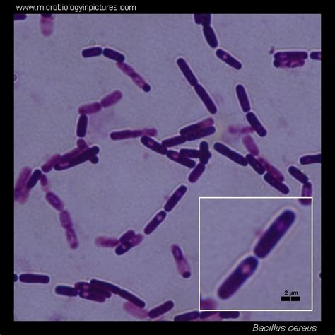 Bacillus cereus microscopy. Bacillus cereus Gram-stain and cell ...