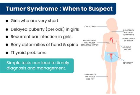 Turner Syndrome Chest