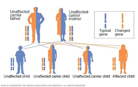 Albinism - Symptoms and causes - Mayo Clinic