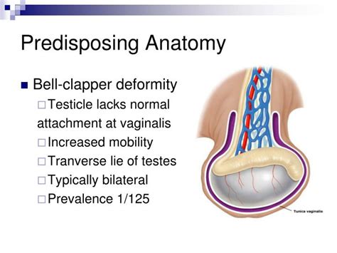 PPT - Urolithiasis. Syndrome of swollen scrotum. PowerPoint ...