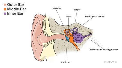 Mastoid Surgery / Cholesteatoma - UPDATE | ENT UK