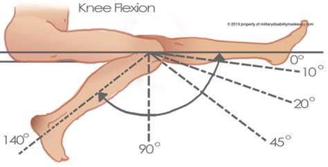 Liposuction Shown to Improve Knee Function