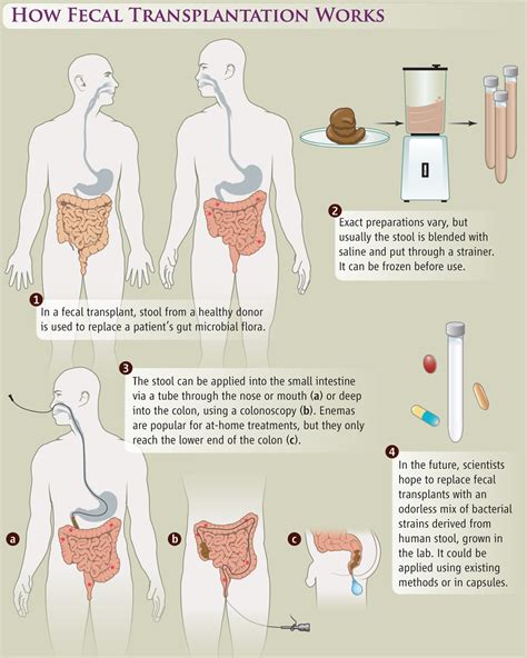 The Promise of Poop | Science