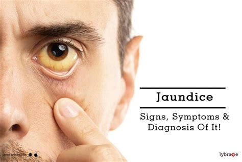 Jaundice - Signs, Symptoms & Diagnosis Of It! - By Dr. Sunaina Rohatgi ...