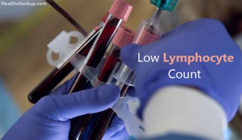 Low Lymphocyte Count Causes, Symptoms, Normal Ranges, Treatment