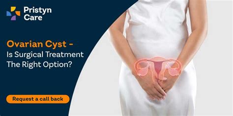 Ovarian Cyst Treatment- Is Surgery The Right Option? - Pristyn Care