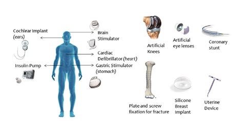 Different implantable medical devices. | Download Scientific Diagram