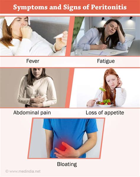 Peritonitis - Causes, Symptoms, Complications, Diagnosis, Treatment ...