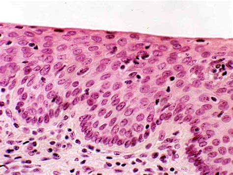 Cells Of Epithelial Tissue | MedicineBTG.com