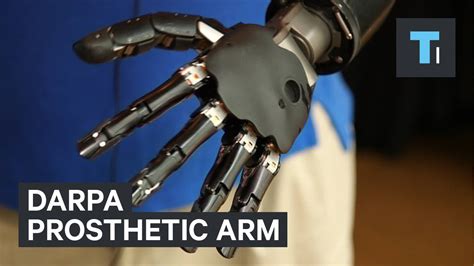 Bionic Arm Prosthetics