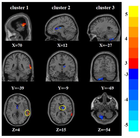 Fmri Brain