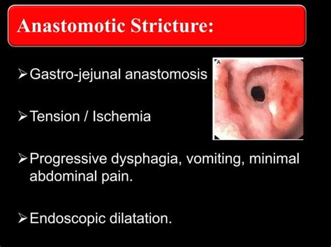 Surgical complications of Gastrectomy