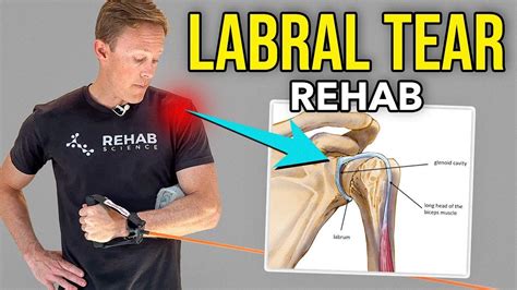 4 Shoulder Labrum Injury Exercises | Shoulder rehab, Shoulder rehab ...